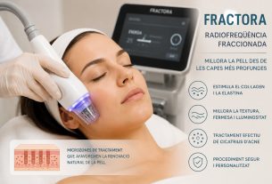 Fractora: radiofreqüència fraccionada per millorar la qualitat de la pell